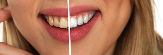 Verbesserung der Zahnhygiene durch den Einsatz einer Munddusche